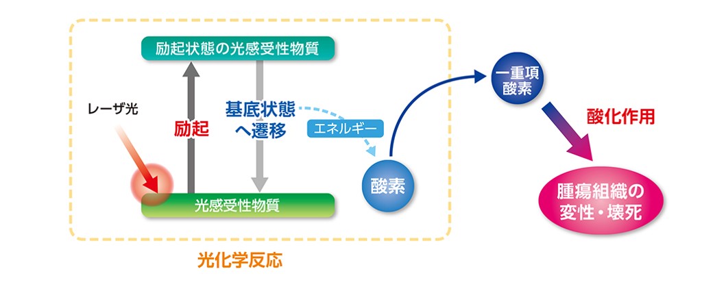 光線力学的療法（PhotodynamicTherapy：PDT）
